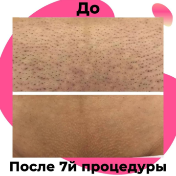 Вау эффект 🤗