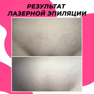 Результат между 1 и 6 процедурой 👍