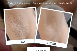 photo_2025-02-08_17-10-30 photo_2025-02-08_17-10-30