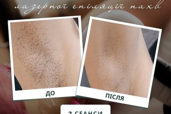 photo_2025-02-08_17-10-30 photo_2025-02-08_17-10-30