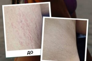 photo_2025-07-26_18-26-07 (11) photo_2025-07-26_18-26-07 (11)