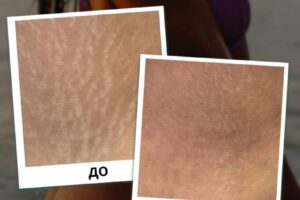 photo_2025-07-26_18-26-07 (5) photo_2025-07-26_18-26-07 (5)