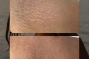 photo_2025-07-26_18-26-07 (7) photo_2025-07-26_18-26-07 (7)