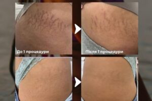 photo_2025-07-26_18-51-21 photo_2025-07-26_18-51-21